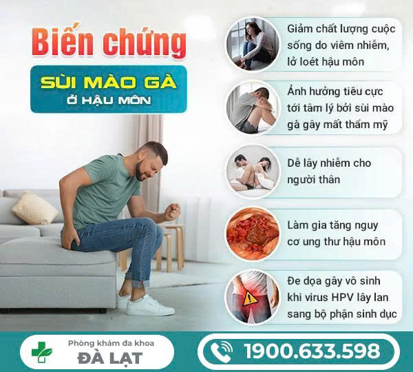 Hình ảnh minh họa